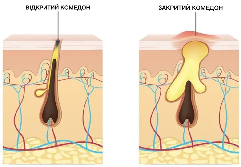 Види камедонів