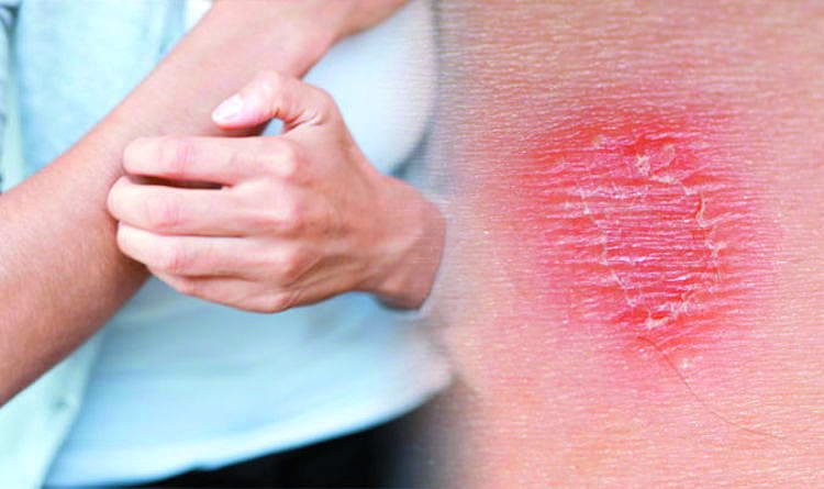 Що викликає запалення шкіри