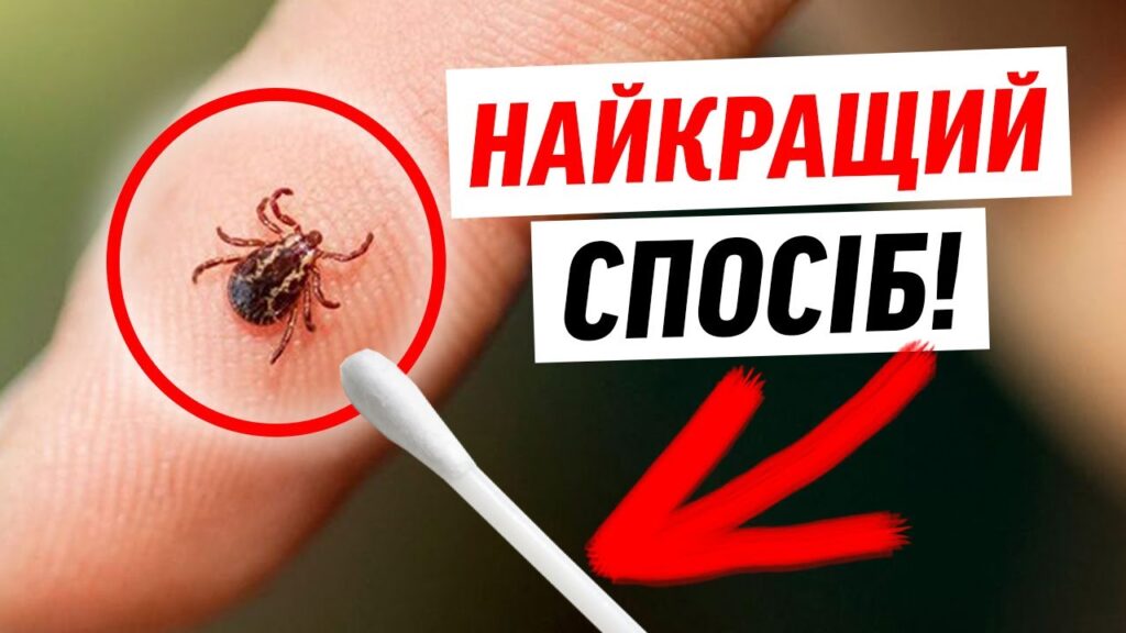 Як видалити кліща