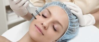 5 преимуществ фракционного лазера для шлифовки кожи